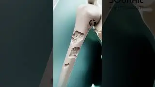 Osteoporosis Animation
