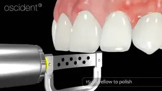oscident IPR instruction 
