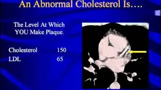Cholesterol and Heart Attack Risks - The Princeton Longevity Center