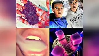 Cheb morad {2018} Chrz Brunne Avec Zakzok REMIX DJ IMAD {22}