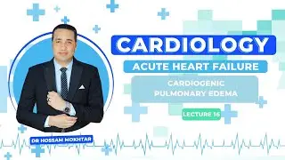 Cardiology - Lec 16 - ll Acute Heart Failure ll (( Cadiogenic Pulmonary Edema ))