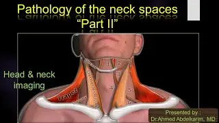 9-pathology of the neck spaces (part II)