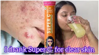 How to get clear skin|Secret for acne-free skin|vitamin-C|Chicnutrix Super C #surabhidhobi #superc