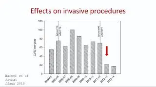 Non invasive prenatal testing by cell-free fetal DNA analysis