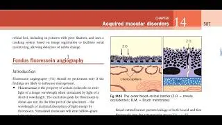 Kanski Clinical Ophthalmology Made Easy - macula 2 (Fundus Fluorescein Angiography)