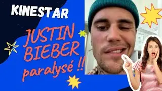JUSTIN BIEBER paralysé: pourquoi ? #justinbieber #biebernews #neurology #kinésithérapie #facial