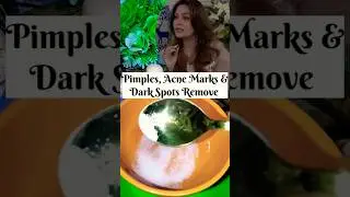 Fade Pimples, Acne Marks & Dark Sports✅Only 2 Ingredients Needed For Your Crystal Clear Face 🌸#viral