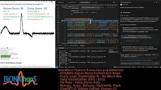 Debugging and Enhancing an ECG Waveform Analysis App with AI and Fuzzy Logic