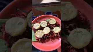 Thattu vadai set #salemthattuvadai #thattuvadaiset #norukkal #chennaifoodie #foodvlog #chennaivlogs