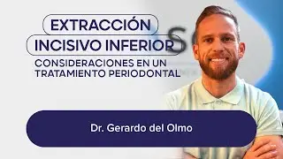 Dr. Gerardo del Olmo - Extracción de un incisivo inferior
