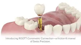 Cement Infection and the Solution HD text