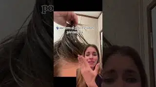 Ten&eacute;s caspa? #haircare