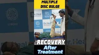 Multiple Disc Bulge Recovery After Treatment #yt #ytshorts #fyp #youtubeshorts #youtube #ad #night