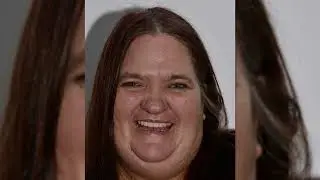 Tammy's Smile Makeover Journey