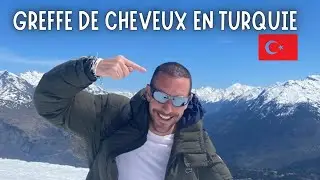 Greffe de cheveux DHI en Turquie. Le point apr&egrave;s 3 semaines (zone donneuse faible) Clinique klin&eacute;va
