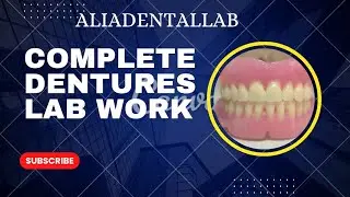 Dentures lab work #dentallab #dentist #dentalclinic #destacar #dental #aliadentallab #short