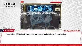 Non-coding RNAs in GI cancers: from cancer hallmarks to clinical utility