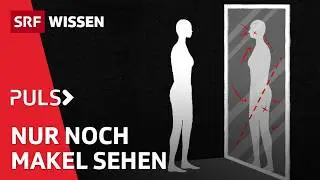 Wie &auml;ussert sich K&ouml;rperdysmorphie (KDS)? | Puls | SRF Wissen