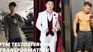 FTM TESTOSTERONE TRANSFORMATION (8 YEARS)