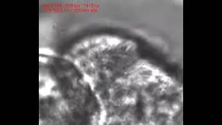 Apical View of Cilia with Gyrating Pattern
