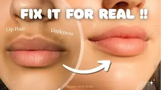 How to get rid of DARKNESS around the mouth 🍒 + Upper lip hair REMOVAL METHODS 🌸