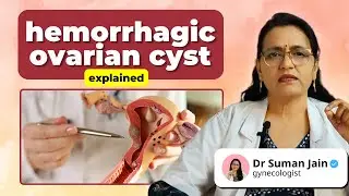 Hemorrhagic Ovarian Cyst: Symptoms, Causes & Treatment | Dr. Suman Jain