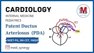 Patent Ductus Arteriosus (PDA) || Integrated Video || Hinglish