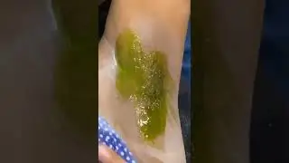 Under Arm Aloe vera Wax😊😊