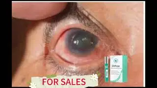 Vision Enhance Roller eliminate fatigue