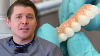 3 Ways to Replace Missing Teeth: Implants, All-on-X & Dentures Explained