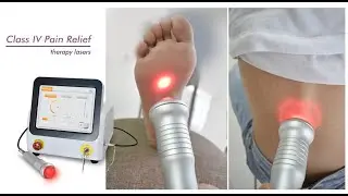 Class 4 Laser Mini 980nm 60W - Domer Laser