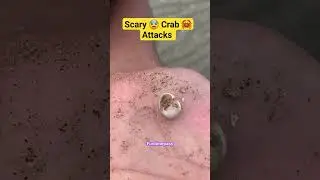 Scary 😨 Crab 🦀 Attack Human 🚶&zwj;♂️