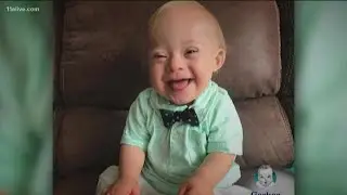 'Any child can be beautiful': Lucas Warren&rsquo;s parents reflect on 'Gerber baby' experience