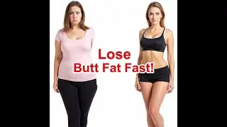 Buttocks fat loss  # youtubpodcast  #slime body #l  #fitnessmotivation #fitness for woman