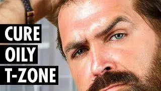 How to Cure an Oily T Zone | What Causes an Oily T Zone? | Tiege Hanley
