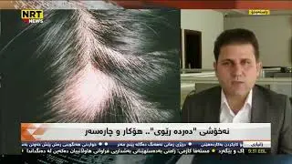 ئایا نه‌خۆشی 