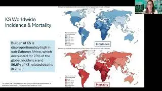 KSHV, Immunity and Cancer: Harnessing Insights into Viral Pathobiology for Therapeutic Intervention