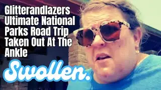 Glitterandlazers Ultimate National Parks Road Trip Taken Out At The Ankle | Reaction