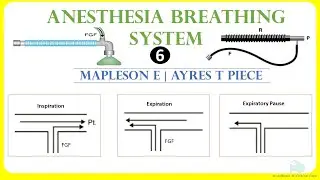 Mapleson E | Тройник Ayres | Дыхательный аппарат для анестезии6