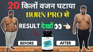 BURN PRO का RESULT देखों | 20 किलों वजन घटाया | SUPPLEMENTS VILLA FAMILY |