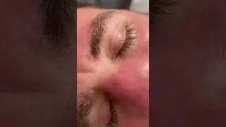 Biggest eyebrow flake ever!