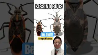 Chagas Disease AKA Kissing Bug Disease  Explained in 60 Seconds