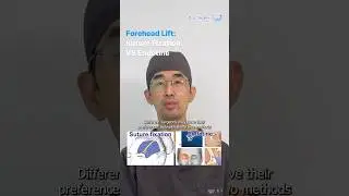 inquiry@docfinderkorea.org 📩What is the difference between forehead endotine and suture fixation?