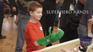 Rice bioengineers use 3-D printers to give kids a hand