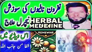 شدید ورم گردہ | Acute brightness disease treatment AyubTibb