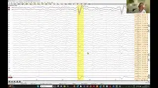 BESA Research Workshop Tutorial 2A: Basic Artifact Correction