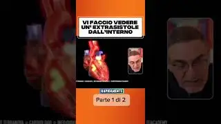 Part 1/2: What an extrasystole looks like from the inside and what happens to the heart during th...