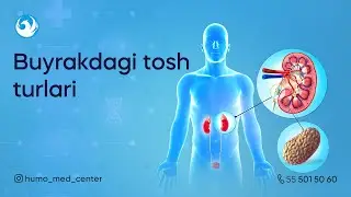 BUYRAKDAGI TOSH TURLARI