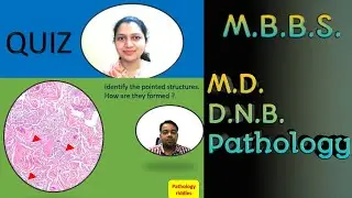 Quiz for Undergraduate Pathology Students MBBS and MD, DNB Students | Questions with Explanation |