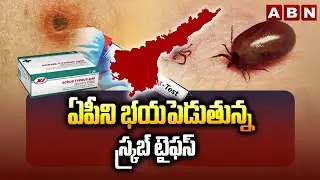ఏపీని భయపెడుతున్న స్క్రబ్ టైఫస్ | 1566 Scrub Typhus Cases In AP | ABN Telugu